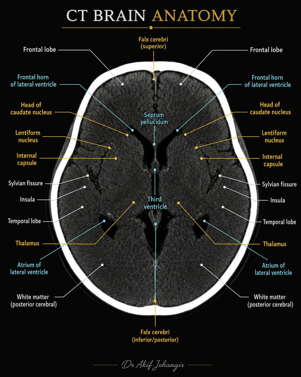 pgMedicine's tweet photo. Save this for revision, share it with your colleagues, and follow for more medical content. https://t.co/Sam516t9C1
