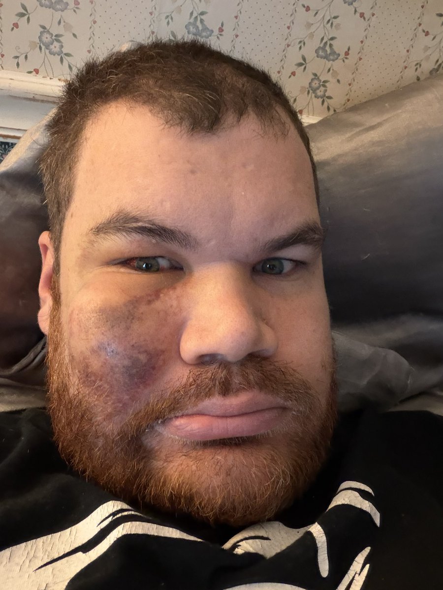 Micah Tolleson tweet media