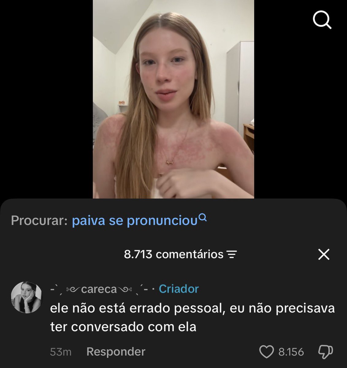 hanruivo's tweet photo. essa soso careca eh mt otaria pqp https://t.co/T4WANkr9fg