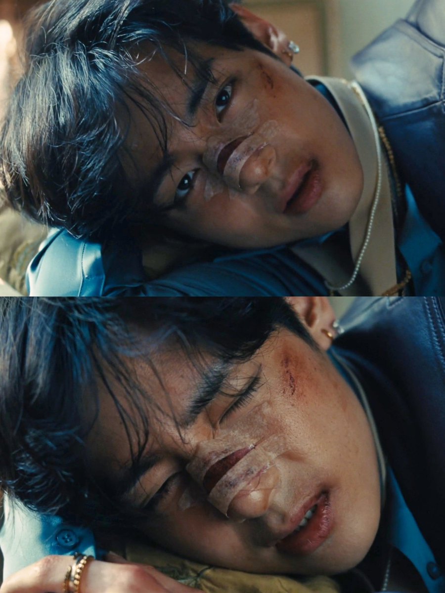cypher0613killa's tweet photo. taehyung is the only member physically bruised in the Normal MV bc hes the fandom's punching bag

thats his normal for 13 years. all their favs perceived failures is his fault. https://t.co/0kIA2yhD3z