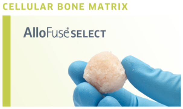 AlloSource's tweet photo. AlloFuse® Select delivers all three properties necessary to support the initiation and nurturing of bone growth at the fusion site of care. Explore the benefits here: https://t.co/oUqQ9tLVOb https://t.co/dJRslRWSaJ