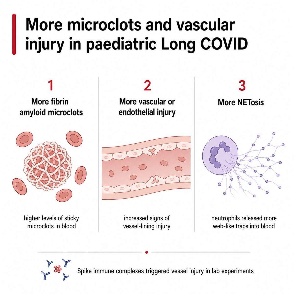 JackHadfield14's tweet photo. An interesting new paediatric Long COVID study found more microclots, more neutrophil trap formation and more vessel-lining injury. In lab work, COVID spike bound to antibodies helped trigger that injury. Let's break it down. https://t.co/ExoZPHAGEO
