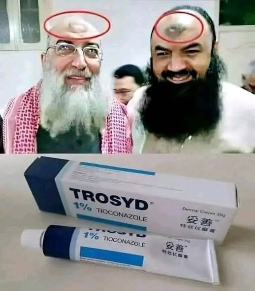 MariaBalochPK's tweet photo. اکثر نمازی اپنی پیشانی پر بنے اس کالے محراب پر فخر کرتے ھیں مگر یہ  "پیراسائیٹک انفیکشن" ھے جو فرش، قالین اور جائے نماز پر  گندے پاؤں کی وجہ سے لگتی ھے۔  Trosyd کریم استعمال کرنے سے یہ نشان ختم ھو جاتا ھے۔
کئی نمازیوں کے ٹخنوں پر بھی یہی " محراب " دیکھا گیا ھے.
رسول اللہ صلی اللہ علیہ وآلہ وسلم سے بڑھ کر کسی نے نہ نماز پڑھی اور نہ طویل سجدے کیے ,
شمائل نبوی میں کہیں  بھی ان محرابوں کا ذکر نہیں
اس لیے اپنے ماتھے رگڑ رگڑ کر خراب مت کریں۔
یہ کریم لگائیں تاکہ انفیکشن ختم ھوجاۓ