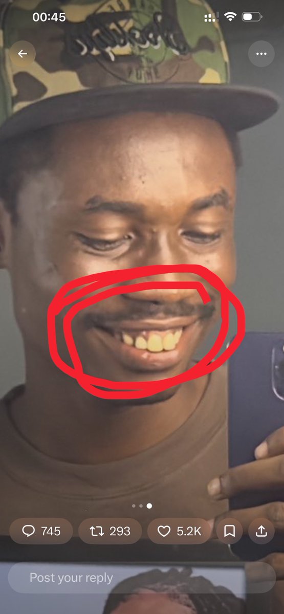 kollyfeelz's tweet photo. Teeth wey doctor Faruq whiten wash which day, dun turn dirty brown color back to the normal color 💔😫 https://t.co/nSMdfnKDkS
