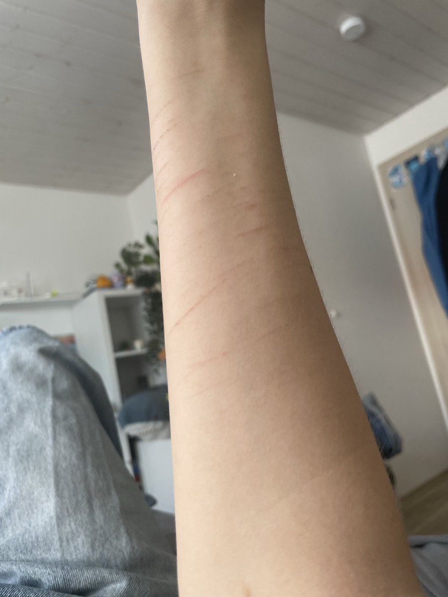 Carochanvt_'s tweet photo. Ugh why don't my cuts ever bleed 😔
(All makeup yeah yeah) #slittwt #shtwt https://t.co/IckWjSYoUX