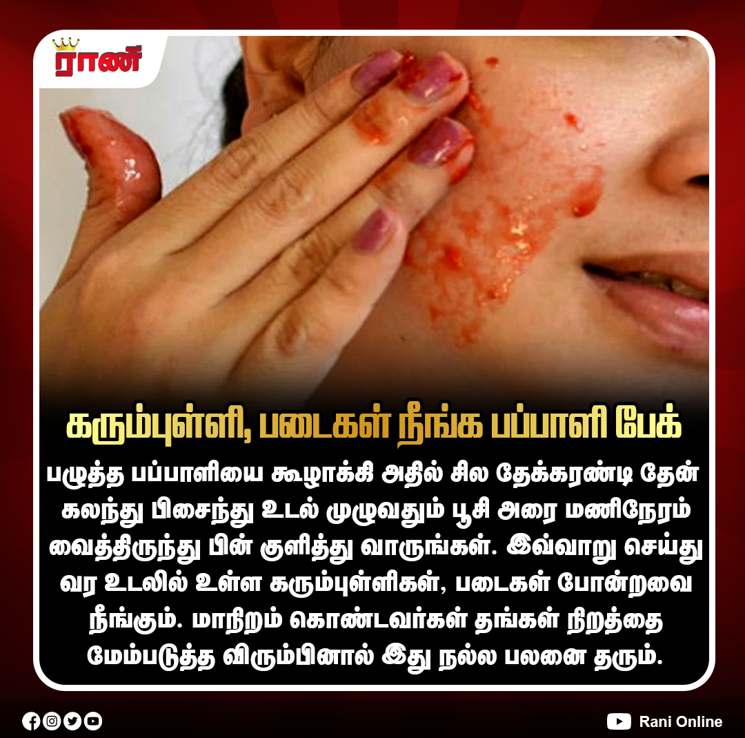 Rani_online's tweet photo. கரும்புள்ளிகள் நீங்கி இயற்கை அழகு பெற பப்பாளி பேக்

#PapayaFacePack #Papaya #NaturalSkincare #GlowingSkin #DarkSpots #Pigmentation #ClearSkin #SkinCareTips #HoneyFacePack #DIYSkincare #HealthySkin #BeautyTips #ranionline https://t.co/MqwyF5v9Pj