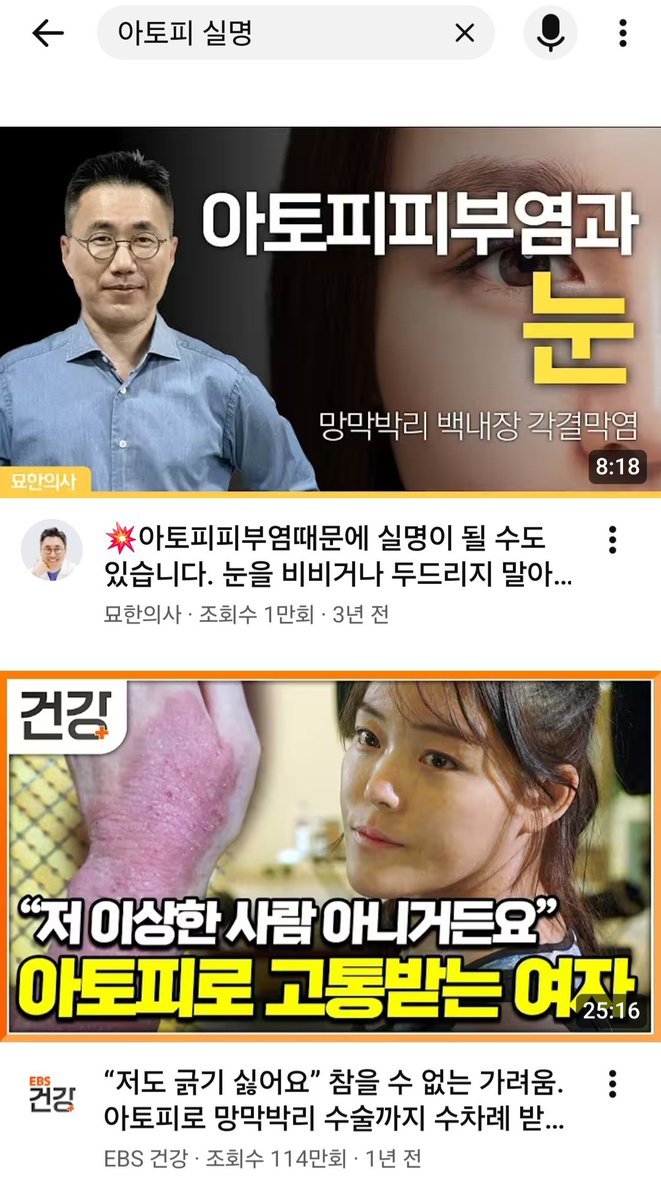 daedsyu86001's tweet photo. 님들 그거 아시나요 아토피 환자들 안 긁으려고 얼굴 두드리거나 때리다가 망막박리 오는 거 꽤 흔함... 검색만 해도 줄줄이 나옴 https://t.co/RJvGeaYHer