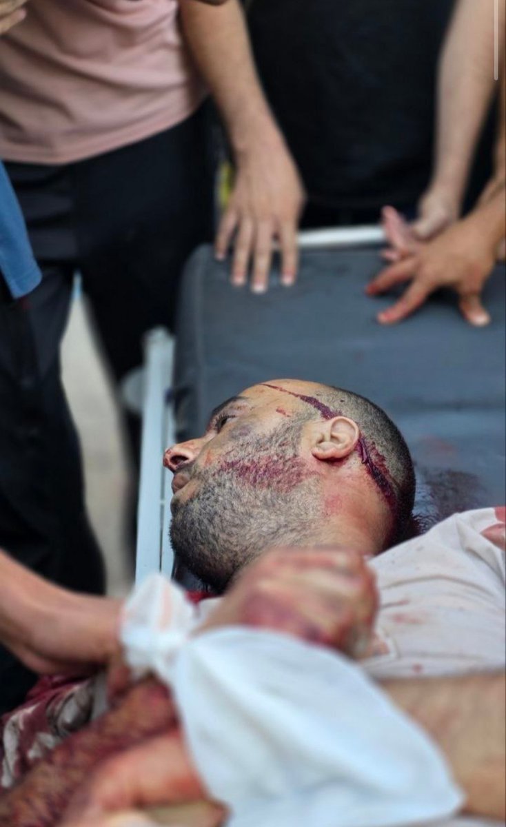 ATrbwsh37772's tweet photo. The Israeli occupation continues to commit massacres in the Gaza Strip, and its inhabitants, especially its children and women, live in increasing fear. They ask for prayers for the martyrs from people of goodwill. 💔🙏🙏
https://t.co/vTLLD1ypKE https://t.co/6XA4uESYIl