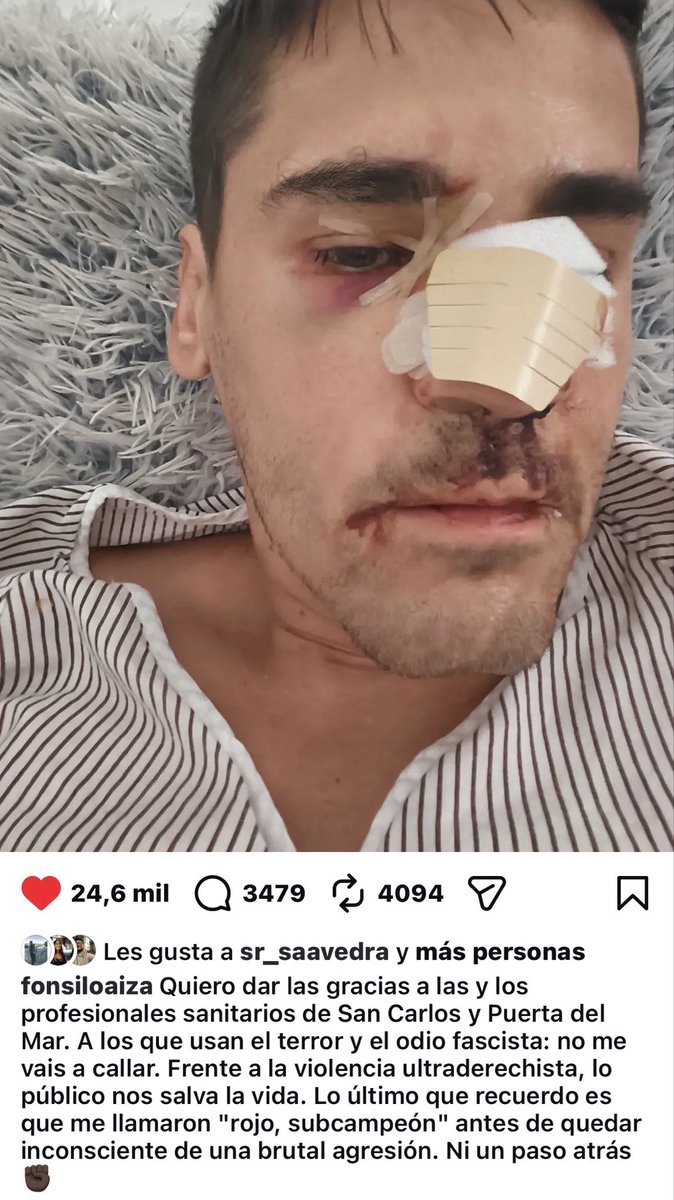PabloEchenique's tweet photo. Si @FonsiLoaiza fuese un periodista de derechas y los que le dieron una paliza fueran izquierdistas, esto abriría especiales en todas las TV, la policía montaría una operación jaula para cazarlos y Marchena los condenaría por sedición en dos tardes.

Democracia ejemplar, ya sabes https://t.co/WaP3TLzBgZ
