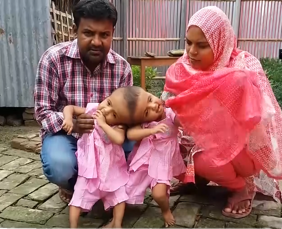 maksud144's tweet photo. জোড়া মাথার যমজদি শিশু রাবেয়া রোগের কথা

#bangladesh #bangla #news #banglanews
#indiarisingwithadani #kolkatanews

Details here: https://t.co/mXBB3UBTkp https://t.co/PO8Y3PHbtP
