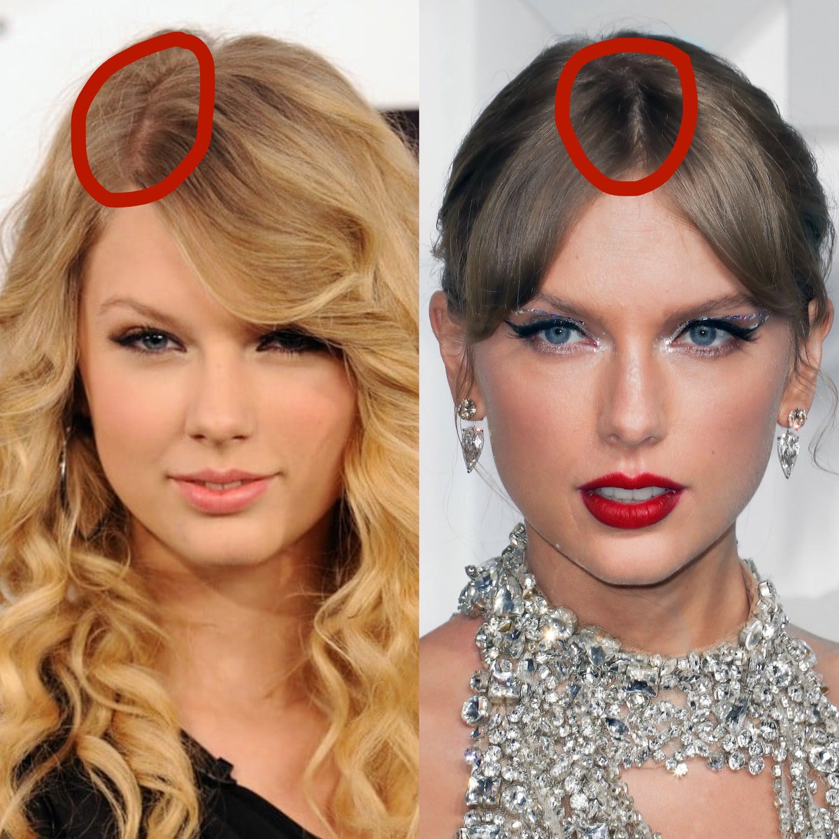 cowboylikezain's tweet photo. how did she move where hair was growing from? https://t.co/RZw5LBuBhS