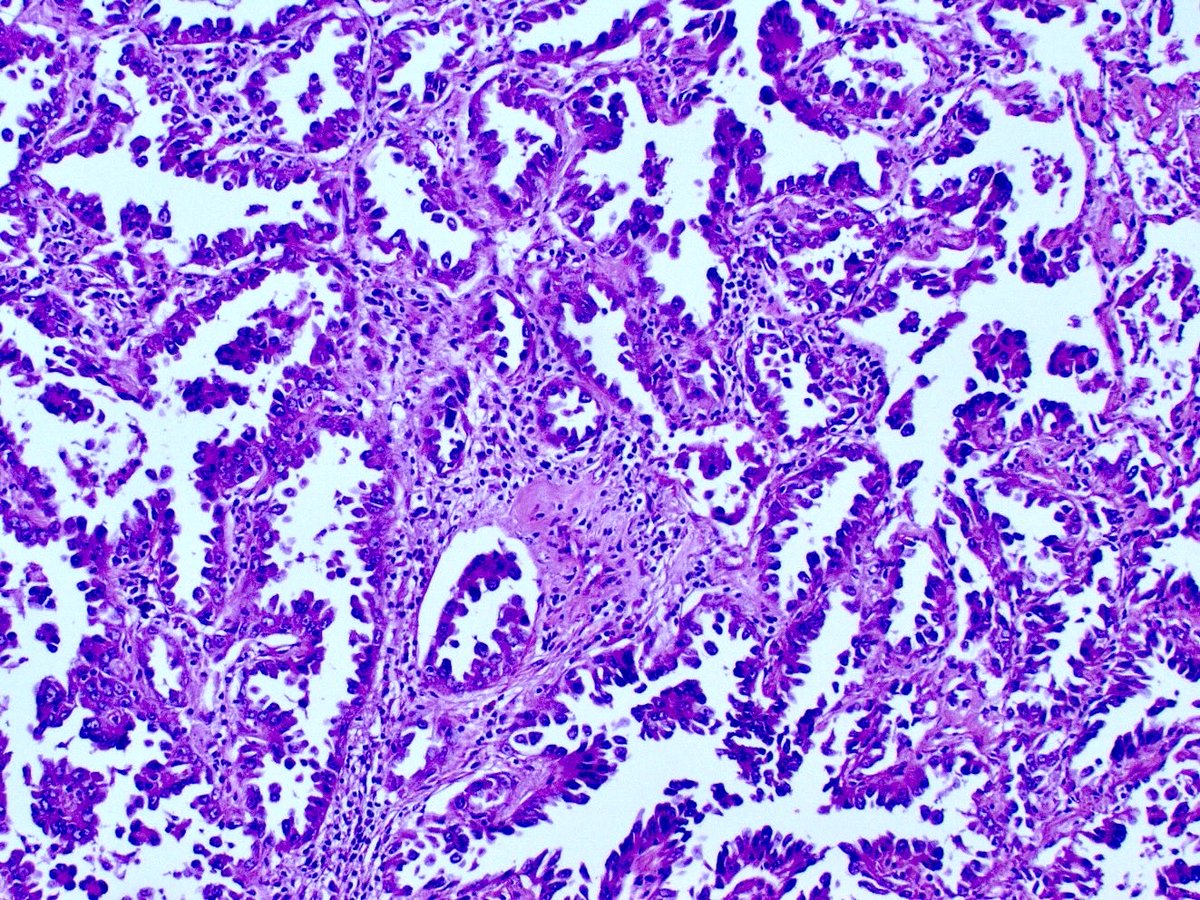 smlungpathguy tweet picture
