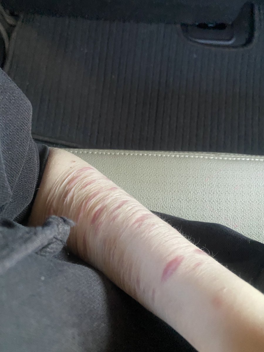Wearehumanz09's tweet photo. Oouu shit is that a scar check..?? 👀👀

Slittwt shtwt shedtwt https://t.co/29KttJ4tux
