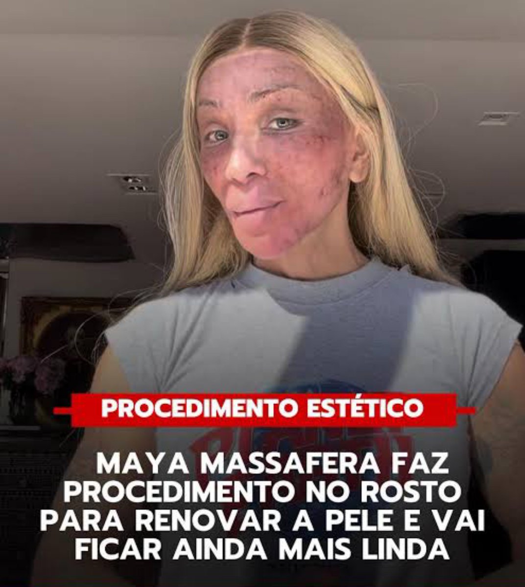 PalhacoFuleiro's tweet photo. Tá parecendo o Calypso do Twisted Metal 😂 https://t.co/ppqFkVGDrE