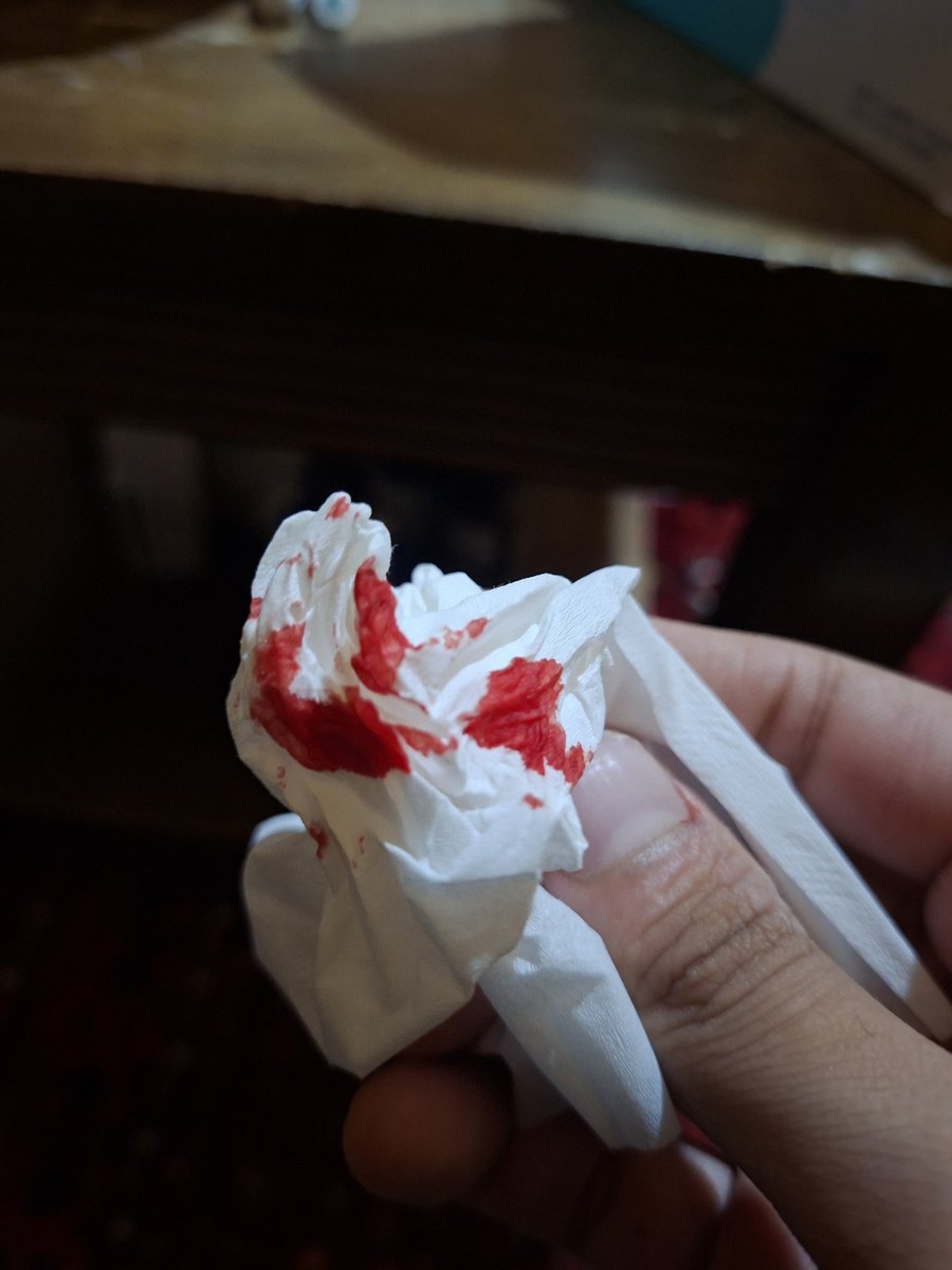 7mdd_hsn34's tweet photo. Im bleeding fountains from my nose... https://t.co/XVyiH4ZV8s
