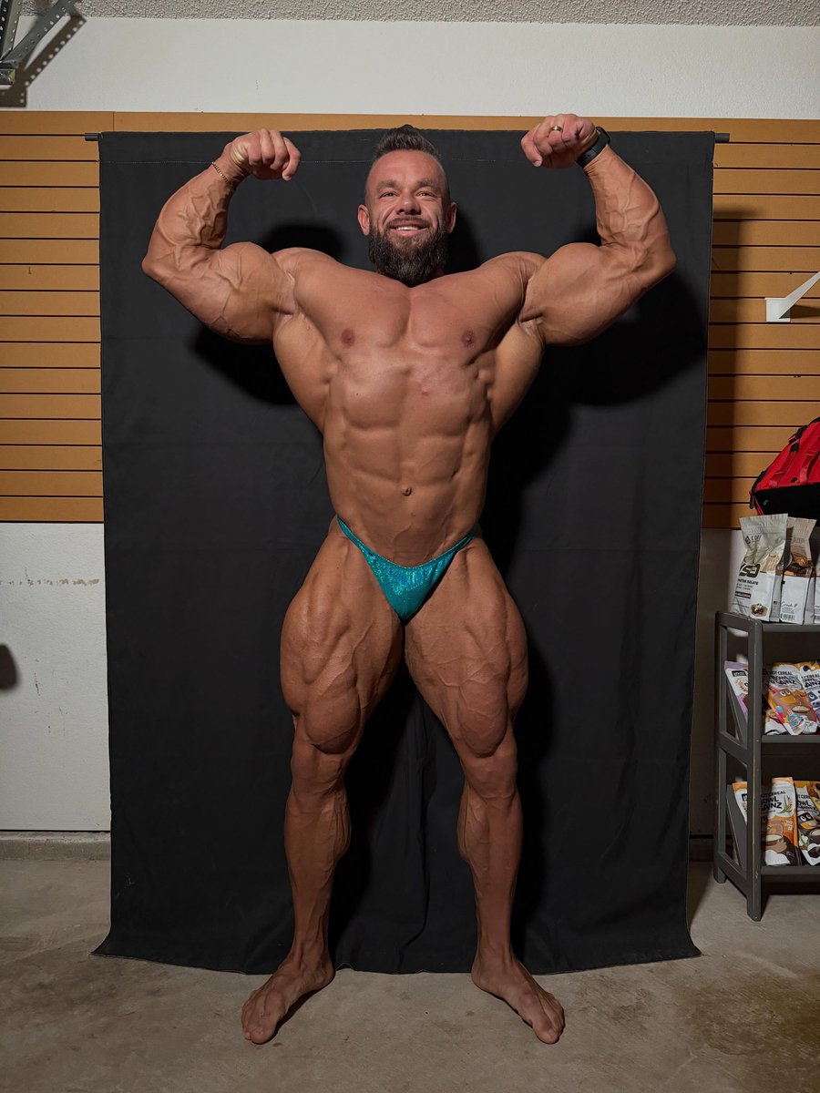 coachdavid167's tweet photo. Everyone wants a body that turns heads.

Very few are willing to build a mindset that never looks for excuses.

The body follows the mind.

#Bodybuilding #GymLife #Discipline

JOIN US ON TELEGRAM 👇👇👇👇👇

https://t.co/ZSsoLQQX5q https://t.co/eXgo80BtxU