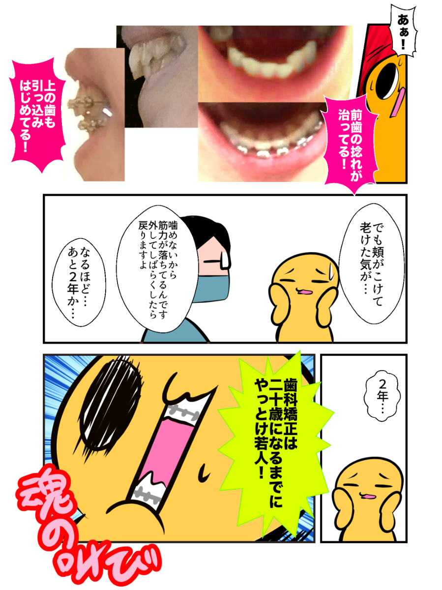 necoguruma3's tweet photo. 【再掲】歯科矯正結果発表　※口内写真有 https://t.co/lUmxCIyVlZ