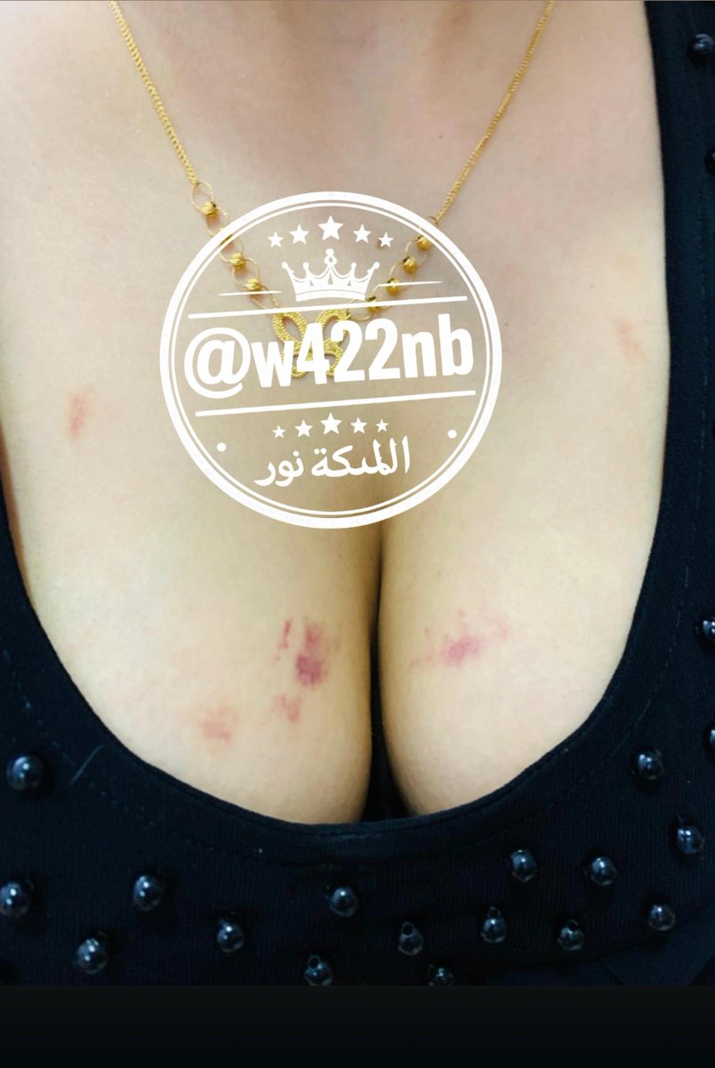w422nb's tweet photo. شسويت بيها 🤤 https://t.co/KHZkb02y17