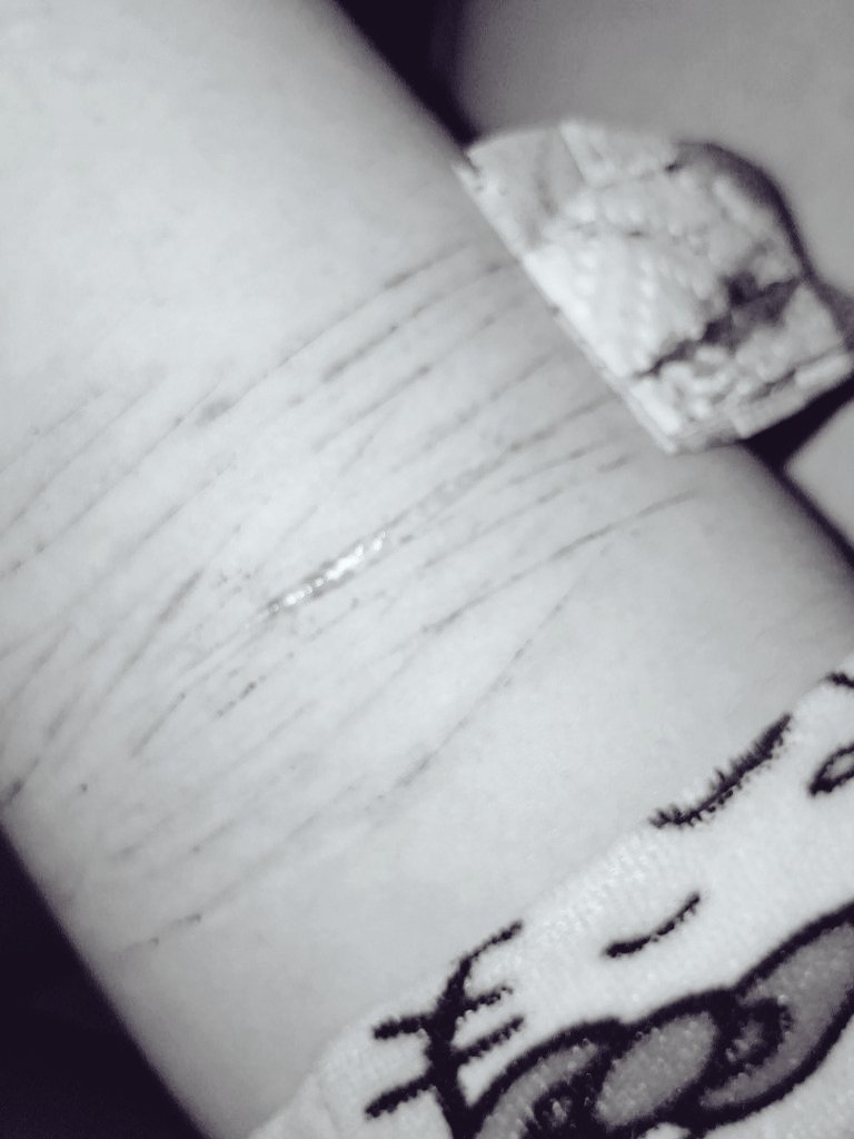 angelwingssbfy's tweet photo. @CandidCupidz Am I lwk a pussy ( I got the cops called on me and got stitches 😭) https://t.co/RUdCoFJKas