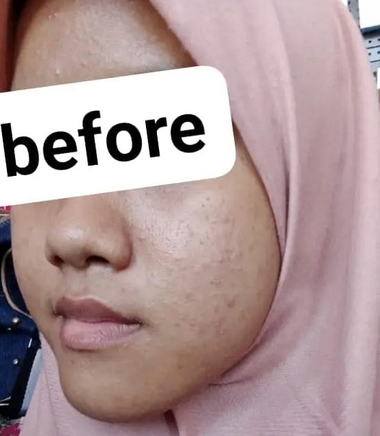 chizuokaa's tweet photo. kulit gw jg pernah se break out itu nder dan penyelamatnya cm facewash senka😭🫶🏻 benerin double cleansing mu nder pake ini

Senka facewash https://t.co/ZPGitjnKBk

trs micellar waternya pake
Facetology combo maut
https://t.co/QpUg26e00w

spill skincare ku yang lain lanjut👇🏻 https://t.co/dzxPSDwgHb