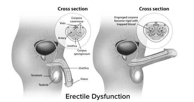 SoyDonParcero's tweet photo. 10 Señales Brutales de que tu Testosterona Está Peligrosamente Baja:

(La Mayoría de los Hombres Tienen 5+ y Ninguna Escuela Te Enseñará)

1. Sin Erección Matutina https://t.co/QVJGlzpqLr