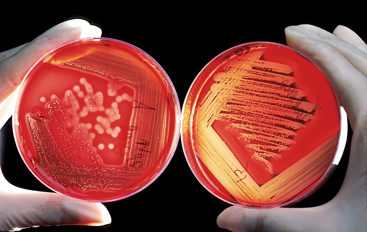 MedLearnHub's tweet photo. Q. The blood agar plate on the left failed to produce isolated colonies primarily because of?

A. Contaminated medium.
B. Heavy inoculum with improper streaking technique.
C. Incubation at low temperature.
D. Incorrect pH of the medium. https://t.co/w3li7Pob5c