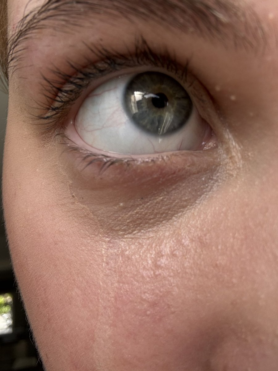 omadluvr's tweet photo. liked my makeup today, shame i had to purge and ruin it https://t.co/aTM66PLi9P