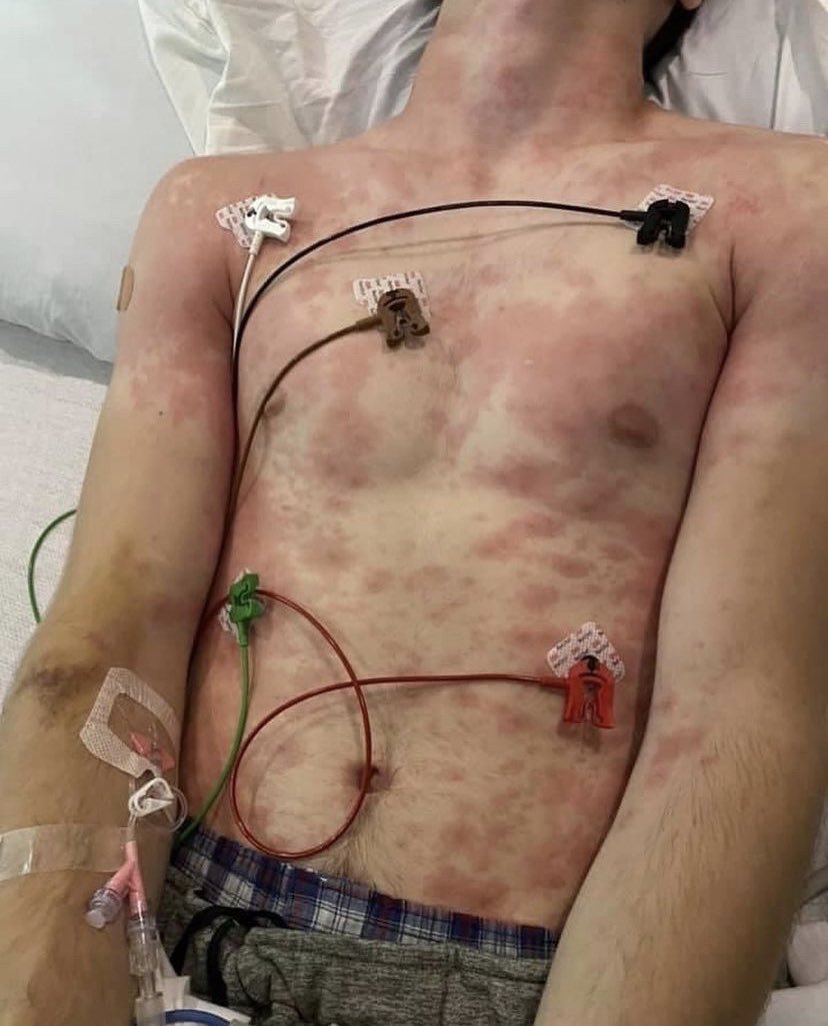 TeamRealityCT's tweet photo. @VacSafety @stkirsch EUA shots STILL mandated for the next generation of nurses, doctors, dentists, PAs, respiratory &amp; speech therapists, etc. 

Yes, the Covid shot is still required in many clinical programs across the US — in July 2026

Some programs boldly state NO exemptions allowed 🚨 https://t.co/RFLhGPhxFo