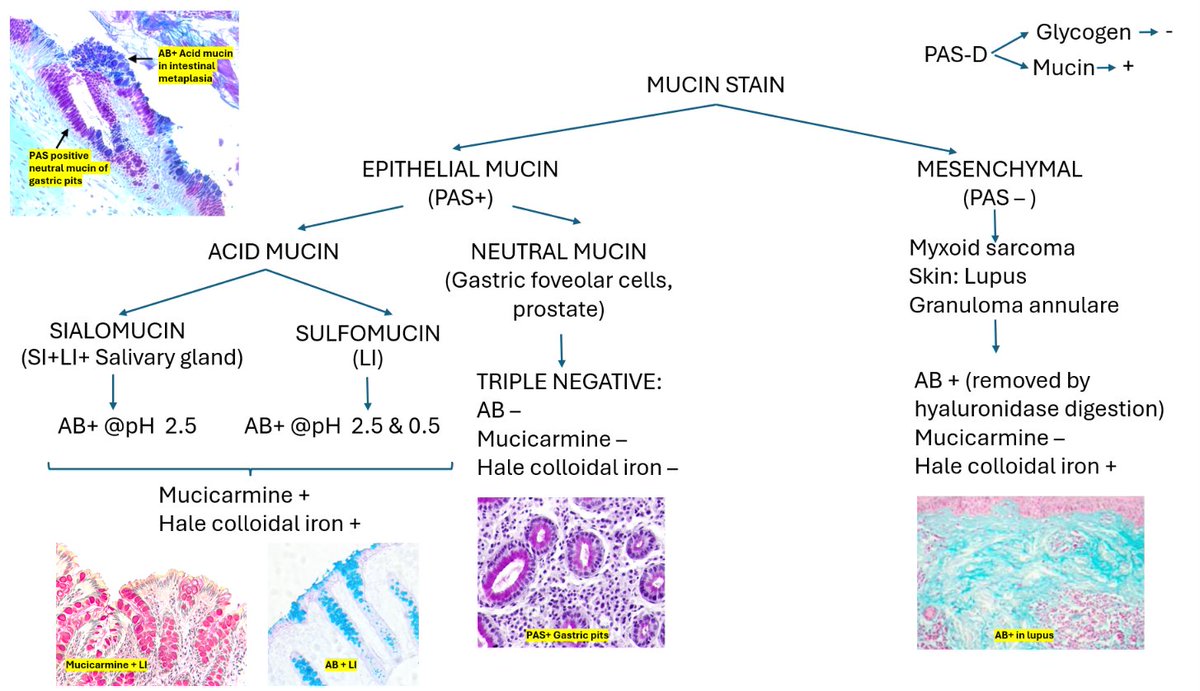 pathognosis22's tweet photo. Starting histotech chapter! 
Today's topic: Special stain: Mucin stain 
#Pathology #Special_stain #Bancroft #Histotech #Labtech #Mucin #PAS #pathognosis #pathtwitter #pathtweet #NEET #NEETSS https://t.co/2AWzJMRdfD