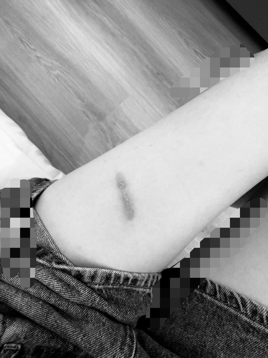 bustedrsou's tweet photo. 🍀 bodycheck!!!
the treatment goes well https://t.co/WSYTsl4tC8