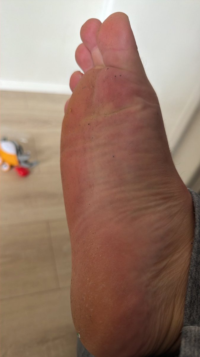 AlexHelders29's tweet photo. 👣 Dirty soles. Clean intentions… maybe. 😉
Think you can handle more? You know where to find it. 😈

#MaleFeet #Feet #FootFetish #Soles #BareFeet #FootLover #FeetPics #FootModel #FootCommunity #MaleCreator #SoloCreator #AdultCreator #AfterDark #NSFW https://t.co/UwYrNci5GC