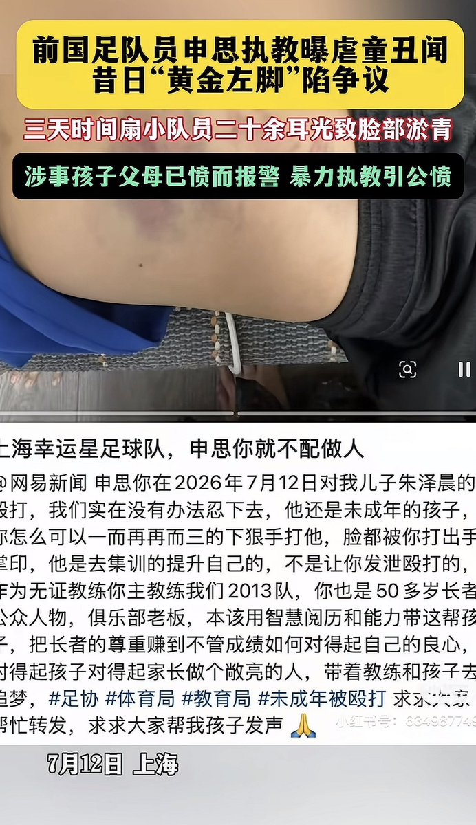 cuichenghao's tweet photo. 什么人品？近日，中国前国足队员、被永久禁赛的申思，暴力教学引起公愤。视频显示，他对一名学员直接扇耳光，行为令人发指。家长反映，三天时间扇了孩子二十多个耳光，致脸部淤青，涉事孩子父母已愤而报警。 https://t.co/4T8xzddtQM