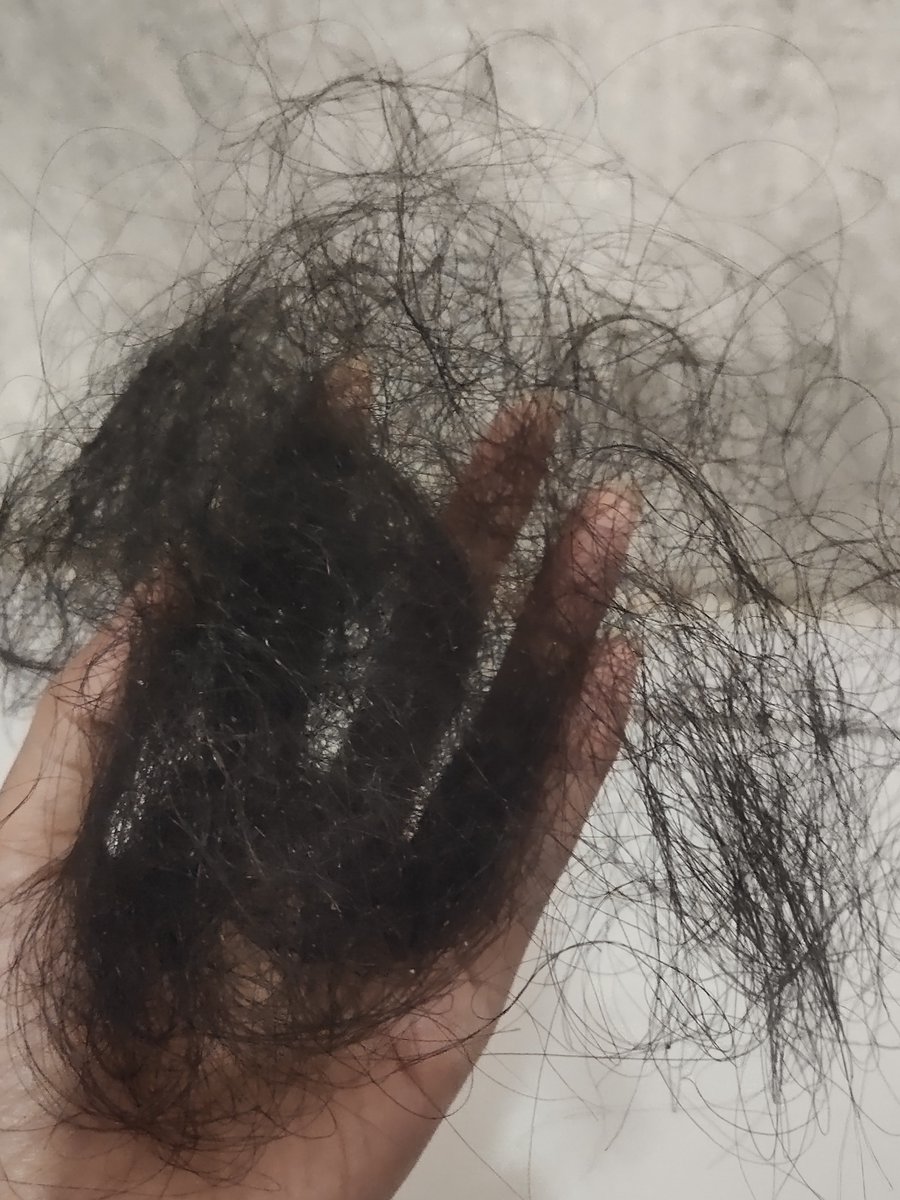 xinxing205's tweet photo. @tanyarlfes Nder dulu juga rambut ku rontok lebih parah dari kamu, saking rontoknya ga berani sisiran, sisiran 1x sehari aja.
Terus aku cobain shampo ini https://t.co/KGZecmfo9D ambil yang paket bundling rontok parah 
Terus minum vitamin hair nail yg ini 
https://t.co/yZsaMyBB1F sama vit d3 https://t.co/4pQKKDmXK0