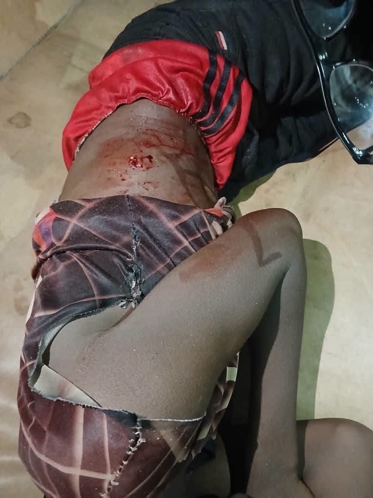 ana_herleemerh's tweet photo. The Fulani Community in Riyom LGA, Plateau State, has strongly condemned the shooting of 18-year-old herder Jafaru Shuaibu by Berom Christians Militias. 

According to the statement, on Friday, 17 July 2026 at about 5:00 p.m., Jafaru and other herders were ambushed by suspected Berom youths from Tanjol while returning from grazing.

 Jafaru sustained critical gunshot injuries and is currently receiving treatment, and one cow was also shot. The community is calling on security agencies to investigate the incident and bring those responsible to justice, while urging its members to remain calm and avoid retaliation.

 They also appealed to the Federal Government, Plateau State Government, and security agencies to strengthen security in Riyom LGA to prevent further violence, and prayed for Jafaru’s speedy recovery.