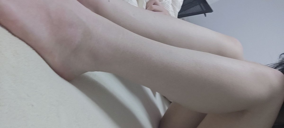 1uochenmiao's tweet photo. 把毛刮掉还蛮白的嘛（好多黑点，不知道激光要做多久才能没有） https://t.co/koiMAAivGy