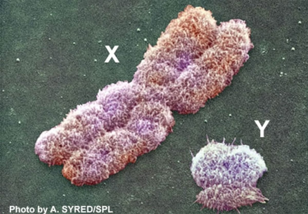 EMundo8888's tweet photo. @WhiteBabyFac The short chromosome starts getting desperate. https://t.co/vj3gHmrKPi