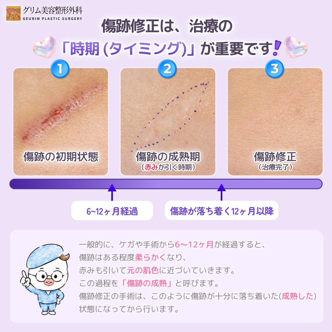 geurimjp's tweet photo. 「もう消えない…」と諦めていたその傷跡、綺麗に整えてみませんか？✨  

ケガや手術、火傷の跡など、どうしても残ってしまった傷跡を 目立たない美しい状態に整える、グリム美容整形外科の「傷跡修正」🩹 

 💡 傷跡修正は「時期（タイミング）」がとっても重要❣️
手術ができるのは、ケガや手術から6〜12ヶ月が経過し、 傷跡十分に落ち着いて柔らかくなった【成熟期】以降になります。  

💡 美しさの秘密は、グリム自慢の「繊細な縫合技術」 皮膚の奥深くから1層ずつ丁寧に「隆起縫合」と「微細縫合」を重ねることで、 傷跡を限りなく目立たない一本の線へと近づけます。  

💡 術後の「アフターケア制度」も徹底❣️
 手術後も定期的な経過観察を行い、 
・傷跡の凹凸を平らにする【傷跡注射】
・赤みや質感を改善する【レーザー治療】 など、状態に合わせた適切なケアを行い、より綺麗な仕上がりへと導きます。 

✨ 口唇口蓋裂の傷跡、手術の縫合跡、水痘の跡、タトゥー除去の跡など、 どんな小さな傷跡の悩みでも、まずは一度ご相談ください 🤍

📲 LINE ID: grkoojp https://t.co/yvQL6PhVus

#グリム美容整形外科 #傷跡修正 #傷跡整形 #傷跡治療 #韓国整形 #渡韓整形 #縫合跡 #火傷跡 #タトゥー除去 #ケガの跡 #水疱瘡の跡 #美容整形 #韓国美容外科 #ビフォーアフター

 https://t.co/4D3kueAcax #Amebaブログ #アメブロ