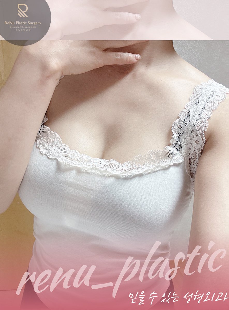trnu2019's tweet photo. 🎀韓国豊胸・脂肪吸引専門 リニュ整形外科 
代表院長が1日たった1人だけ手術 

10年以上、ずっと豊胸手術を悩まれていた患者様🤍
旦那様の反対もありましたが、
自信を取り戻したいという想いで
リニュにご来院くださいました😊

「自然な仕上がりがいい」
「大きすぎる胸にはしたくない」

C〜Dカップを目安に、
体に一番似合うサイズをご希望✨

術後は理想のDカップに💖
「もっと小さくしていたら後悔していたと思います。」
と、とても喜んでいただきました！

リニュでは、
手術中にもサイズを確認しながら、
お一人おひとりに合った
一番美しいサイズへ仕上げています🥰
#メンターブースト　#メンター　#シリコン豊胸　#豊胸レポ