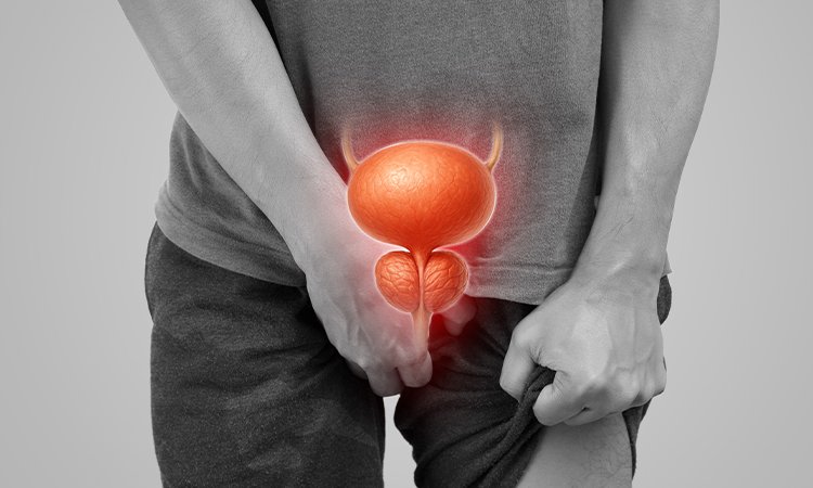 DedayoRoots's tweet photo. Prostate cancer is the most common cancer in Nigerian men.

PSA screening rates are below 5%.

Most cases are found at advanced stage.

Herbs that protect this gland are growing in every Nigerian compound.

The men who need them most have never been told.

That changes today. 🧵 https://t.co/Ab0BbrnrRX
