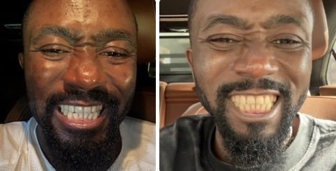 EdeboJ81314's tweet photo. Today makes it 4 months in... No smoke, No Dentist !! God so good inna me life, If i can do it hommie it can be done 😀🚭 https://t.co/W9qyScm3YY