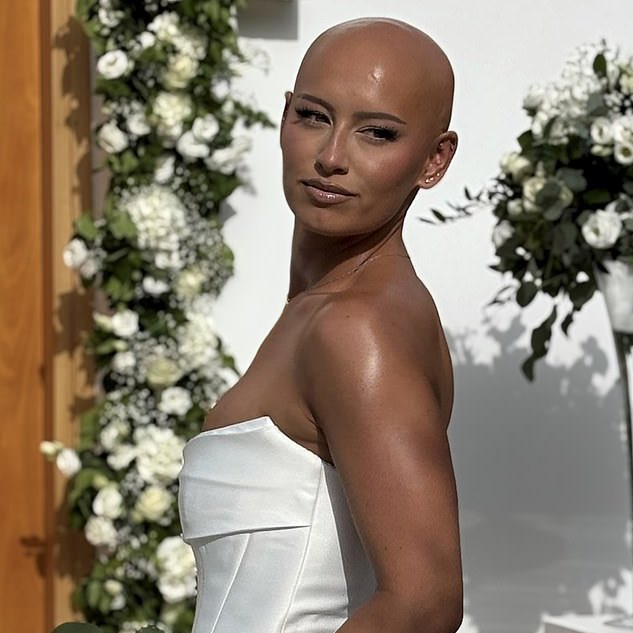 AcervoCharts's tweet photo. Mulher com alopecia decidiu se casar sem usar peruca pela primeira vez.

O desejo partiu do marido de Dani, que afirmou amá-la de qualquer forma. https://t.co/UFafdWK7Ra