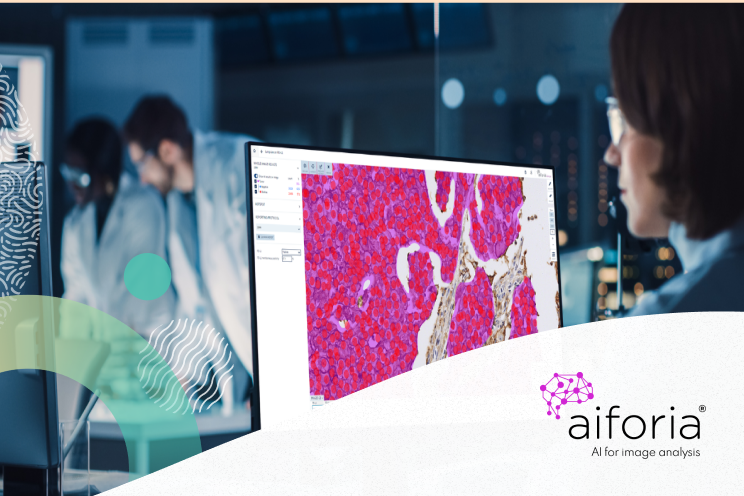 bikrantb's tweet photo. Up to 68% faster diagnostic processing. 

See how Aiforia and the NHS are using AI-assisted pathology to help advance cancer care. Read more: https://t.co/jY2fxh9SpC

#MSFTAdvocate https://t.co/8uovZib5iK