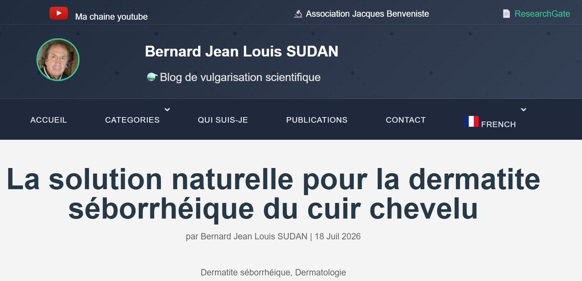 BernardSudan's tweet photo. La solution naturelle pour la dermatite séborrhéique du cuir chevelu #Dermatologie #dermatite #cuirchevelu #solutionnaturelle #allergie
https://t.co/cwachS6C1j https://t.co/ptKItw4H4P