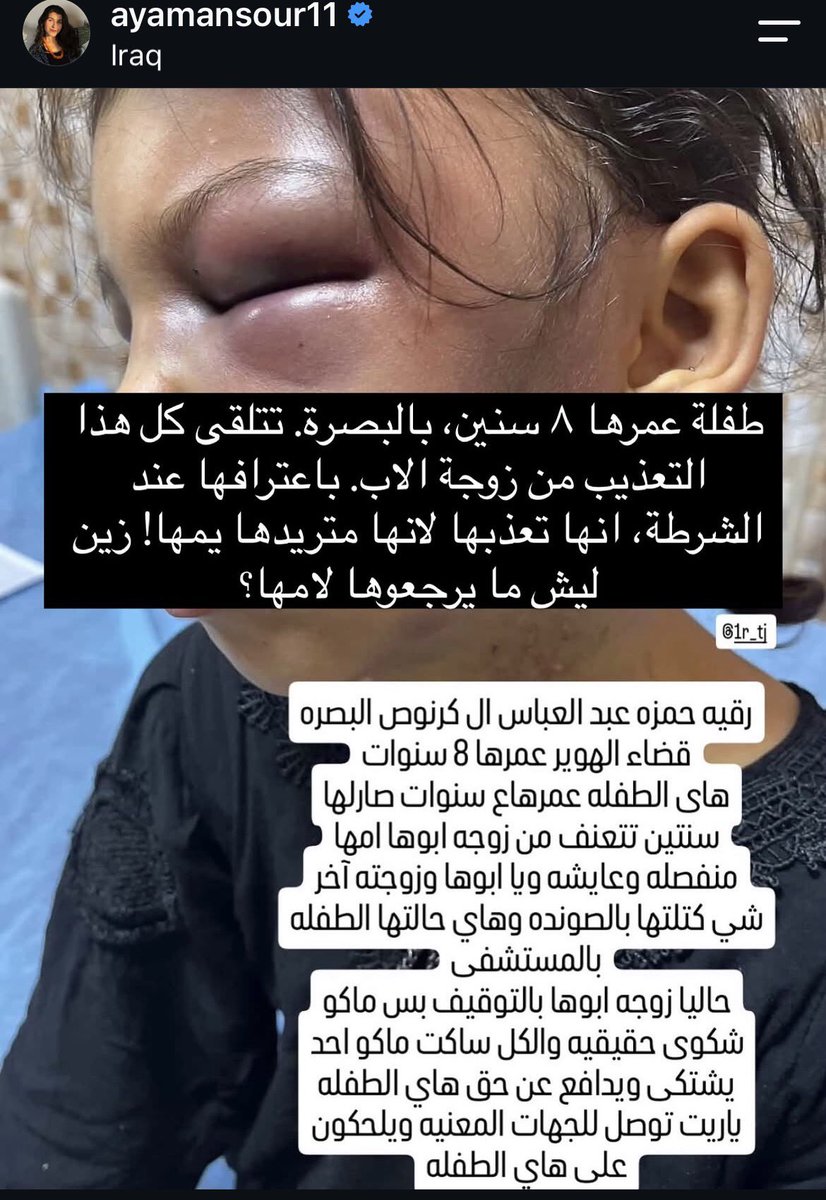 partynextnourr's tweet photo. بس اريد افتهم شغلة وحدة
متوازين عالخلفة لو متوازين عالزواج ماكدر اتقبل ولا افتهم او اتفهم الاهالي الخرا هاي ولا الي تتزوج واحد عنده كوم جهال وتعذبهم من كسر ان شاء الله بايدج ولا تتهنين بحياتج على هاي الدكة الخايسة عين البنية رايحة!!جمالة ماكو داعي دعوى،تنتقمين من طفلة شنو بعقلج https://t.co/9NRfLrfHSb