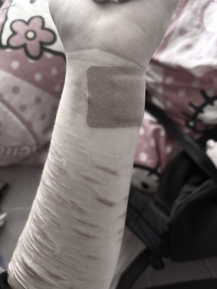 chthonicsymphon's tweet photo. scars reveal ^_^ https://t.co/HSee84lhR8