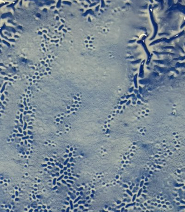 Dedeyanium's tweet photo. 大きなシワも良いんですが、個人的には斑点状に発生している小さなシワにも注目してもらえるとシワ発生についての奥深さが見えて面白いかもです。 https://t.co/PoEdXV1kzD