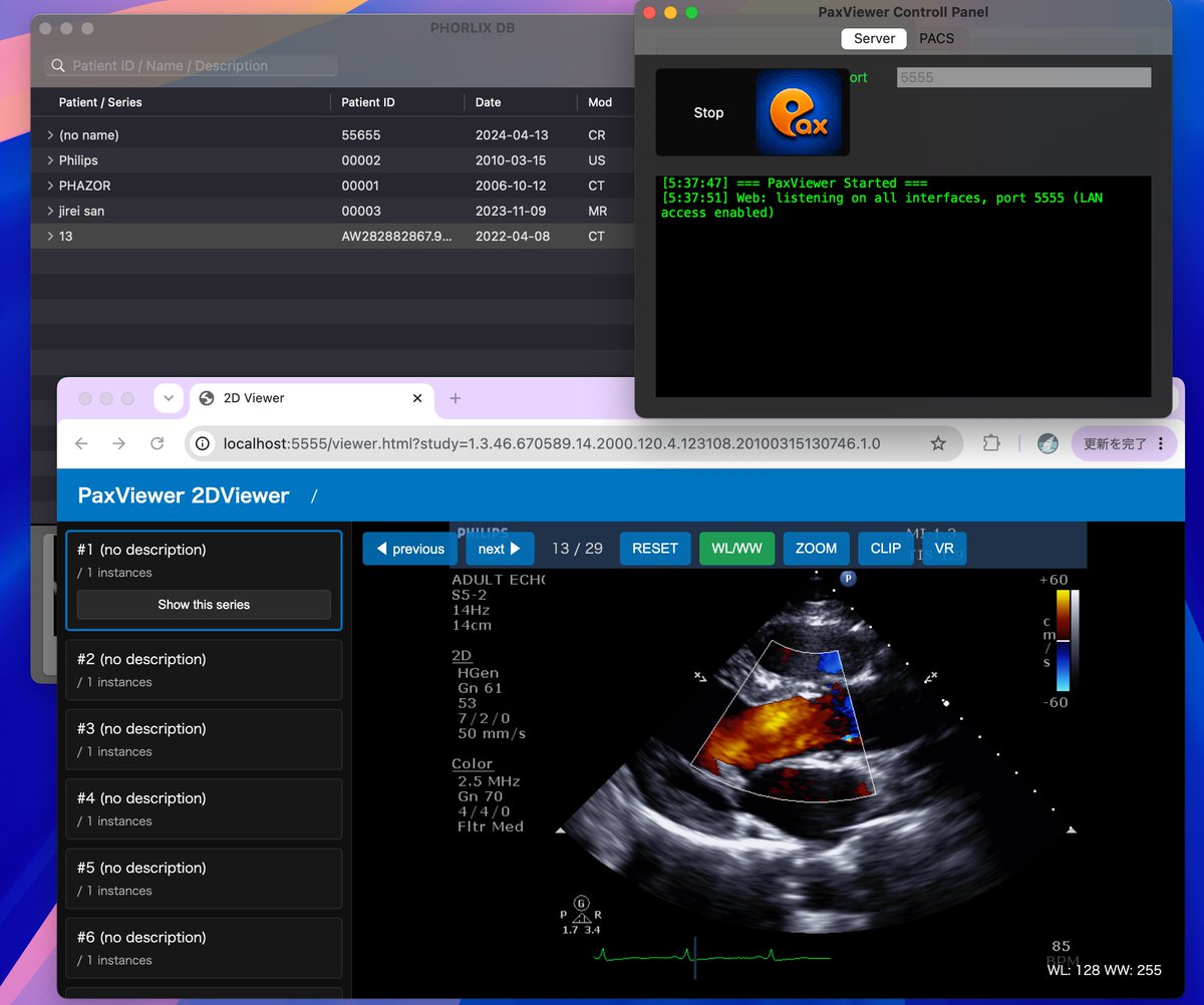 air_h_128k_ilI's tweet photo. AppStore v1.0.2 もきちゃあ。
・Webサーバ機能
・DICOM Tag 編集機能
などが追加になっています。
https://t.co/w8JfCYKFnR
#dicom #macOS #PACS https://t.co/F5m3dbNVKW