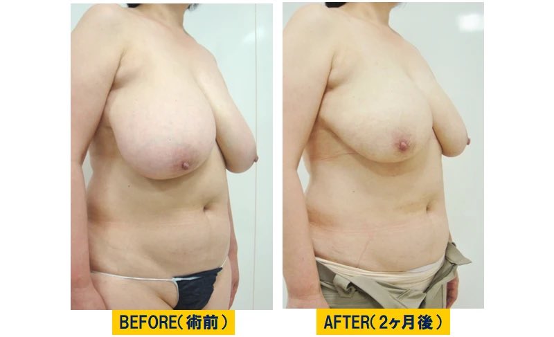 Walavi072's tweet photo. 垂れた乳した50過ぎたおばさん体型のBBAが一番チンポに効く。リアルでセックスするならBBAが良い。というより、��ンズリのネタにするのもBBA。 https://t.co/7Rwef8Bqzq