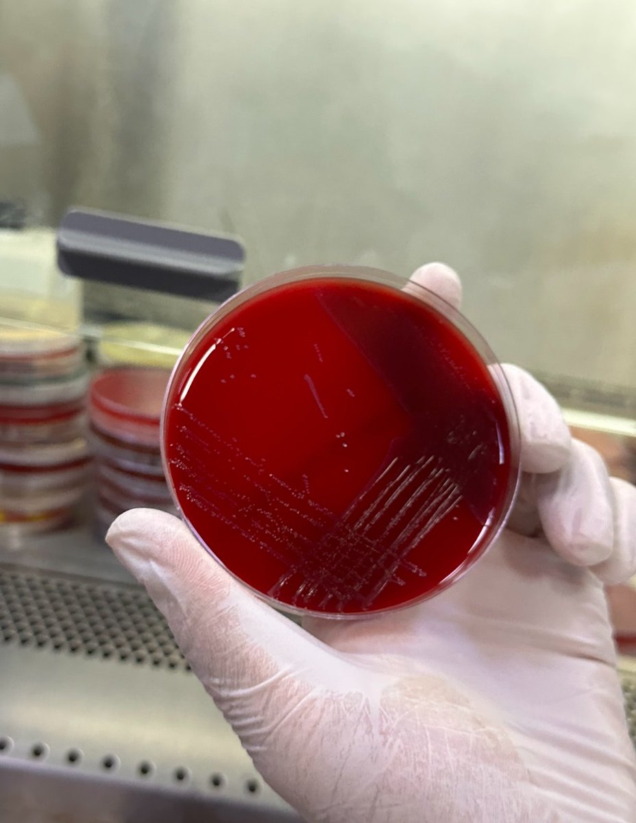 Lamy434's tweet photo. Blood Agar: لتنمية البكتيريا وكشف انحلال الدم.
MacConkey Agar: لعزل البكتيريا سالبة الجرام.
Chocolate Agar: لتنمية البكتيريا صعبة النمو.
CLED Agar: لزراعة عينات البول https://t.co/rnJLKIiSUC