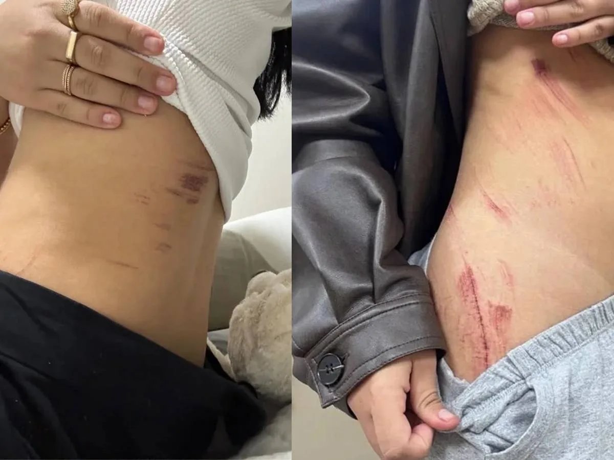 LesbophobiaRCPT's tweet photo. A Lesbian couple (19 &amp; 20 yrs old) was raped by an armed 42-yr-old homeless man, Paulo Sérgio Sousa, in Brasília, June 30th.

The disgusting pig held both of them hostage for 2 hours by taking advantage of them being a couple. Threatening to kill one if the other reacted! https://t.co/EwbHIBnscf
